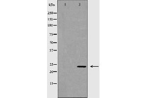 Western blot analysis of K562 cell lysate, using RAB27A Antibody. (RAB27A antibody  (C-Term))