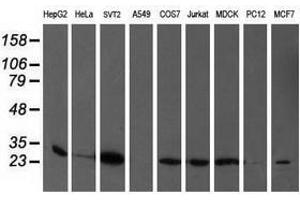 Image no. 2 for anti-phosphoglycerate Mutase 2 (Muscle) (PGAM2) antibody (ABIN1500171) (PGAM2 antibody)