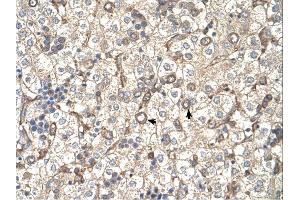 ST3GAL4 antibody was used for immunohistochemistry at a concentration of 4-8 ug/ml. (ST3GAL4 antibody  (Middle Region))