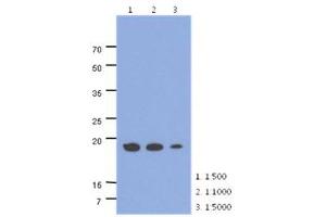 The cell lysates of HepG2 (40ug) were resolved by SDS-PAGE, transferred to PVDF membrane and probed with anti-human MRPS25 antibody (1:500 ~ 1:1000).