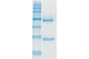 Image no. 1 for anti-Toxin A antibody (ABIN335169) (Toxin A antibody)