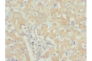 Immunohistochemistry of paraffin-embedded human liver tissue using ABIN7174300 at dilution of 1:100 (USP26 antibody  (AA 664-913))