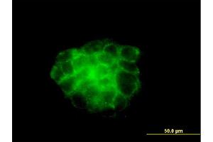 Immunofluorescence of monoclonal antibody to KRT4 on A-431 cell. (KRT4 antibody  (AA 194-300))