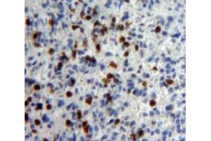 IHC-P analysis of Spleen tissue, with DAB staining. (IFNA5 antibody  (AA 22-189))