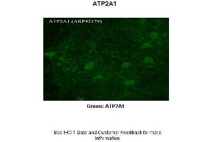 Sample Type :  Rhesus macaque spinal cord  Primary Antibody Dilution :  1:300  Secondary Antibody :  Donkey anti Rabbit 488  Secondary Antibody Dilution :  1:500  Color/Signal Descriptions :  Green: ATP2A1  Gene Name :  ATP2A1  Submitted by :  Timur Mavlyutov, Ph.