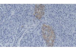 Detection of NMES1 in Human Pancreas Tissue using Polyclonal Antibody to Normal Mucosa Of Esophagus Specific 1 (NMES1) (NMES1 antibody  (AA 1-83))