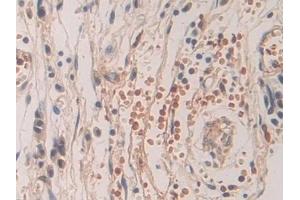 Immunohistochemistry (IHC) image for anti-SHC (Src Homology 2 Domain Containing) Transforming Protein 3 (SHC3) (AA 188-433) antibody (ABIN7443536)