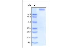 Human Leptin R, Fc Tag on SDS-PAGE under reducing (R) condition. (Leptin Receptor Protein (LEPR) (AA 22-839) (Fc Tag))