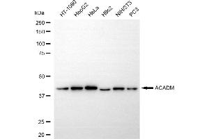 Western blotting analysis using ACADM antibody (ABIN7799351). (Recombinant Medium-Chain Specific Acyl-CoA Dehydrogenase, Mitochondrial (MCAD) antibody)