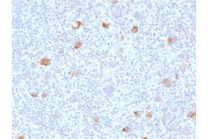 Immunohistochemistry (IHC) image for anti-BCL2-Like 1 (BCL2L1) (AA 1-135) antibody (ABIN6940516) (BCL2L1 antibody  (AA 1-135))