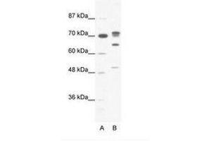 Image no. 1 for anti-DEAD (Asp-Glu-Ala-Asp) Box Polypeptide 21 (DDX21) (N-Term) antibody (ABIN6736053) (DDX21 antibody  (N-Term))