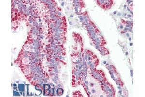 ABIN768615 (5µg/ml) staining of paraffin embedded Human Small Intestine. (SON antibody  (N-Term))