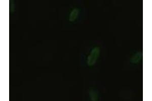 Anti-BFGF mouse monoclonal antibody (ABIN2452354) immunofluorescent staining of HeLa cells transiently transfected by pCMV6-ENTRY BFGF (RC217426) (FGF2 antibody  (AA 10-155))