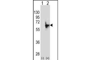 Western blot analysis of NMT2 (arrow) using rabbit polyclonal NMT2 Antibody (E31) (ABIN389095 and ABIN2839287). (NMT2 antibody  (N-Term))