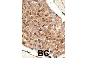 Immunohistochemistry (IHC) image for anti-Bone Morphogenetic Protein 10 (BMP10) antibody (ABIN5018806) (BMP10 antibody)