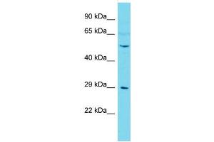 Host:  Rabbit  Target Name:  Camk4  Sample Type:  Mouse Testis lysates  Antibody Dilution:  1. (CAMK4 antibody  (C-Term))