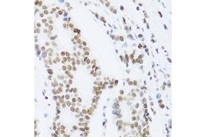 Immunohistochemistry (Paraffin-embedded Sections) (IHC (p)) image for anti-Nuclear Factor of kappa Light Polypeptide Gene Enhancer in B-Cells 2 (NFKB2) (AA 690-899) antibody (ABIN3017388)