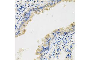 Immunohistochemistry of paraffin-embedded mouse lung using CXCL8 antibody (ABIN3172524) at dilution of 1/100 (40x lens). (IL-8 antibody)