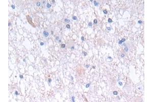 Immunohistochemistry (IHC) image for anti-Glycolipid Transfer Protein (GLTP) (AA 2-209) antibody (ABIN7443623)