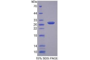SDS-PAGE analysis of Human MYT1 Protein. (MYT1 Protein)