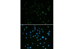 Immunofluorescence analysis of A549 cell using MSH6 antibody. (MSH6 antibody)