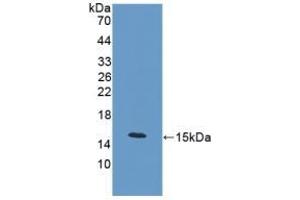 Detection of Recombinant PCT, Mouse using Polyclonal Antibody to Procalcitonin (PCT) (Procalcitonin antibody  (AA 26-136))