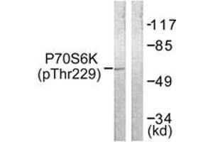 Western blot analysis of extracts from Jurkat cells, using p70 S6 Kinase (Phospho-Thr229) Antibody. (RPS6KB1 antibody  (pThr229))