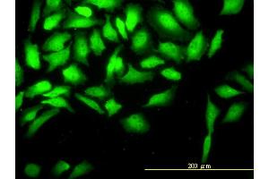 Immunofluorescence of monoclonal antibody to CKS2 on HeLa cell. (CKS2 antibody  (AA 1-79))
