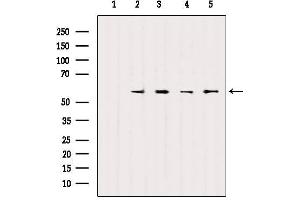 Western blot analysis of extracts from various samples, using SOX9 Antibody. (SOX9 antibody)