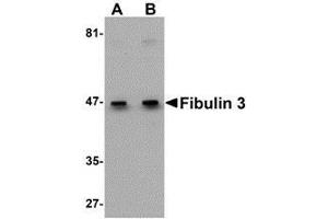 Western blot analysis of Fibulin 3 in HeLa cell lysate with AP30337PU-N Fibulin 3 antibody at (A) 0.