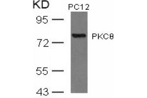 Image no. 3 for anti-Protein Kinase C, theta (PRKCQ) (AA 674-678) antibody (ABIN197567) (PKC theta antibody  (AA 674-678))