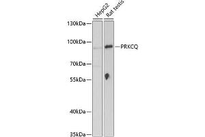 Western blot analysis of extracts of various cell lines, using PRKCQ Antibody (ABIN6128466, ABIN6146208, ABIN6146209 and ABIN6221529) at 1:1000 dilution. (PKC theta antibody  (AA 1-230))