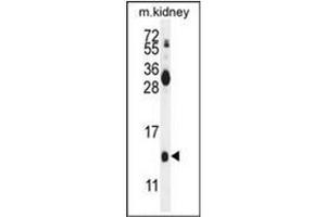 Western blot analysis of Midkine Antibody (C-term) in mouse kidney tissue lysates (35ug/lane). (Midkine antibody  (C-Term))