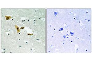 APLF antibody  (Ser116)