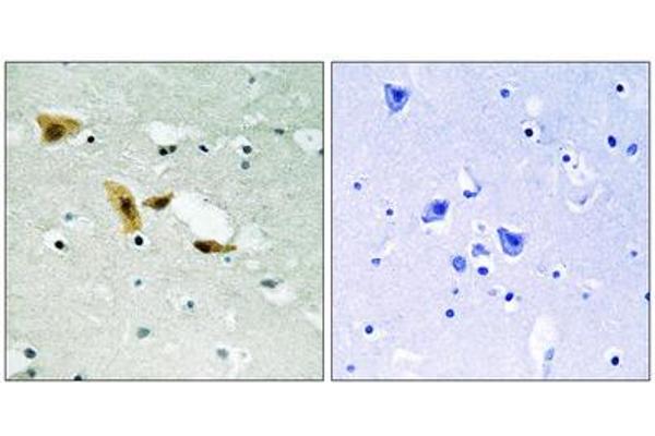 APLF antibody  (Ser116)