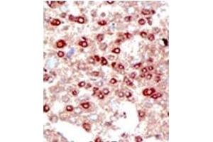 Image no. 3 for anti-Small Ubiquitin Related Modifier 3 (SUMO3) (C-Term) antibody (ABIN356741) (SUMO3 antibody  (C-Term))