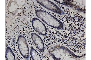 Immunoperoxidase of monoclonal antibody to RABGAP1L on formalin-fixed paraffin-embedded human small Intestine. (RABGAP1L antibody  (AA 1-110))