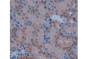 Used in DAB staining on fromalin fixed paraffin- embedded kidney tissue (ABCB10 antibody  (AA 457-715))