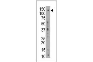 ABCB11 antibody  (C-Term)