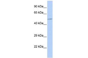 B4GALT3 antibody used at 1 ug/ml to detect target protein. (B4GALT3 antibody  (Middle Region))