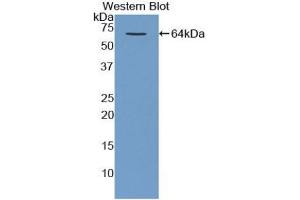 Detection of Recombinant MBP, Human using Polyclonal Antibody to Major Basic Protein (MBP) (Major Basic Protein antibody  (AA 105-222))