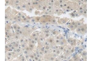 Detection of CRP in Human Liver Tissue using Polyclonal Antibody to C Reactive Protein (CRP) (CRP antibody  (AA 17-224))