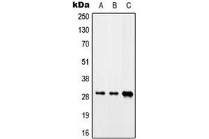 Western blot analysis of CIP29 expression in Jurkat (A), mouse heart (B), rat liver (C) whole cell lysates. (SARNP antibody  (C-Term))