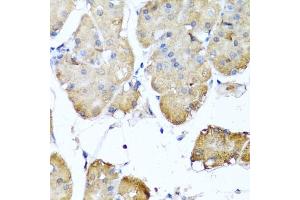 Immunohistochemistry of paraffin-embedded human stomach using NIN antibody (ABIN6129422, ABIN6144630, ABIN6144632 and ABIN6224239) at dilution of 1:100 (40x lens). (Ninein antibody  (AA 1-287))