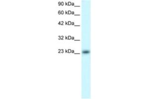 Western Blotting (WB) image for anti-MAX Dimerization Protein 4 (MXD4) antibody (ABIN2460569)