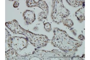 Immunostaining (ISt) image for anti-RNA Binding Motif Protein 9 (RBM9) (AA 1-100) antibody (ABIN565111)