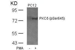 Western blot analysis of extracts from PC12 cells untreated or treated with PMA using PKCd(Phospho-Ser645) Antibody. (PKC delta antibody  (pSer645))