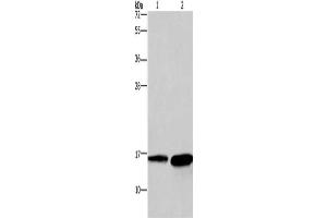 Gel: 12 % SDS-PAGE, Lysate: 40 μg, Lane 1-2: Mouse heart tissue, human hepatocellular carcinoma tissue, Primary antibody: ABIN7129699(HINT2 Antibody) at dilution 1/300, Secondary antibody: Goat anti rabbit IgG at 1/8000 dilution, Exposure time: 20 seconds
