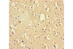 Immunohistochemistry of paraffin-embedded human brain tissue using ABIN7164380 at dilution of 1:100 (DHX35 antibody  (AA 1-300))