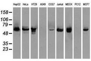 Image no. 3 for anti-Checkpoint Kinase 2 (CHEK2) antibody (ABIN1497500) (CHEK2 antibody)